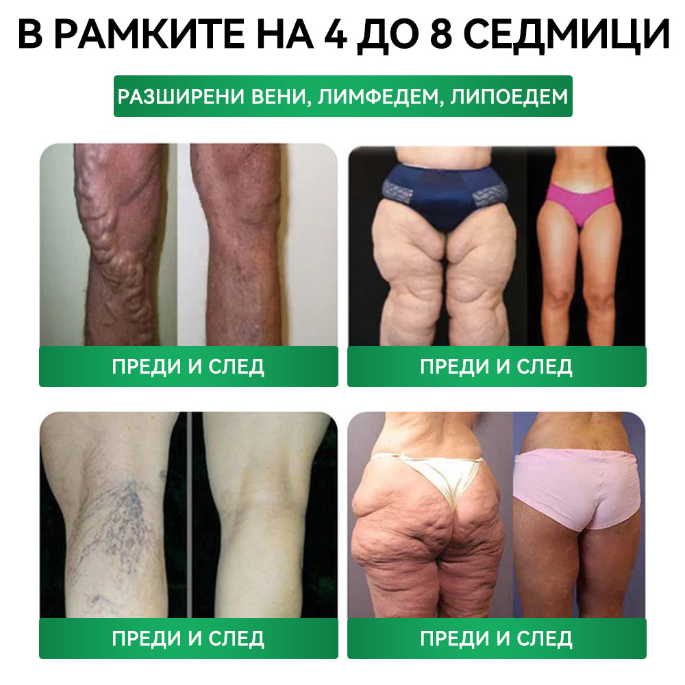 Официален магазин |𝑪𝑼𝑺𝑰𝐉𝐀𝐒® Moringa · Берберин × НАД+ Напреден пластър с нано-микроигли 10 в 1🇧🇬(Само веднъж дневно, видими промени вече след 7 дни)✅ За затлъстяване, влакнеста кожа, диабет, сънна апноя, стопански проблеми и много други🌱
