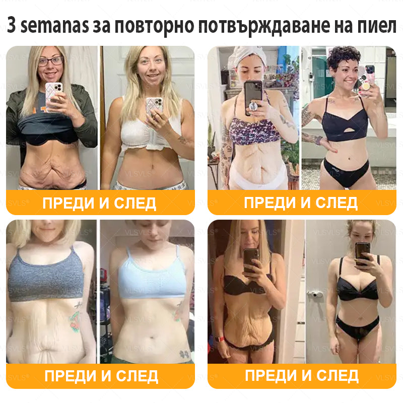 VLSVLS® ПЧЕЛНА ОТРОВА Комплексен крем - Последен ден 80% ОТСТЪПКА (Отпусната кожа, фини бръчки, загуба на стегнатост, плоски гърди, отпуснат ханш и още)🌴🌴