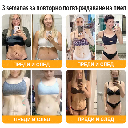 VLSVLS® ПЧЕЛНА ОТРОВА Комплексен крем - Последен ден 80% ОТСТЪПКА (Отпусната кожа, фини бръчки, загуба на стегнатост, плоски гърди, отпуснат ханш и още)🌴🌴