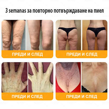 VLSVLS® ПЧЕЛНА ОТРОВА Комплексен крем - Последен ден 80% ОТСТЪПКА (Отпусната кожа, фини бръчки, загуба на стегнатост, плоски гърди, отпуснат ханш и още)🌴🌴