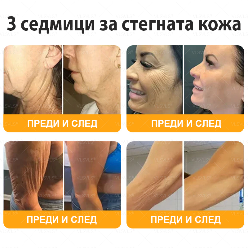 VLSVLS® ПЧЕЛНА ОТРОВА Комплексен крем - Последен ден 80% ОТСТЪПКА (Отпусната кожа, фини бръчки, загуба на стегнатост, плоски гърди, отпуснат ханш и още)🌴🌴
