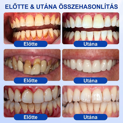 ⚪Dr.Era® GumRevive fogíny- és parodontális regeneráló gél — Célzott ápolás az ínyszélen lepedék, fogszuvasodás, fogágyproblémák, kellemetlen lehelet és meggyengült fogak esetén | Precízen alkalmazható, leöblítést nem igénylő szájápoló formula