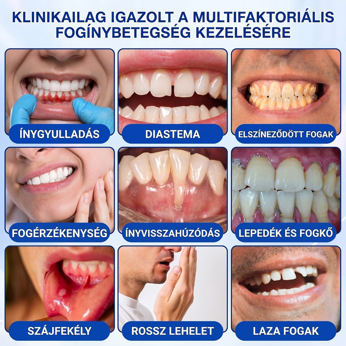 ⚪Dr.Era® GumRevive fogíny- és parodontális regeneráló gél — Célzott ápolás az ínyszélen lepedék, fogszuvasodás, fogágyproblémák, kellemetlen lehelet és meggyengült fogak esetén | Precízen alkalmazható, leöblítést nem igénylő szájápoló formula
