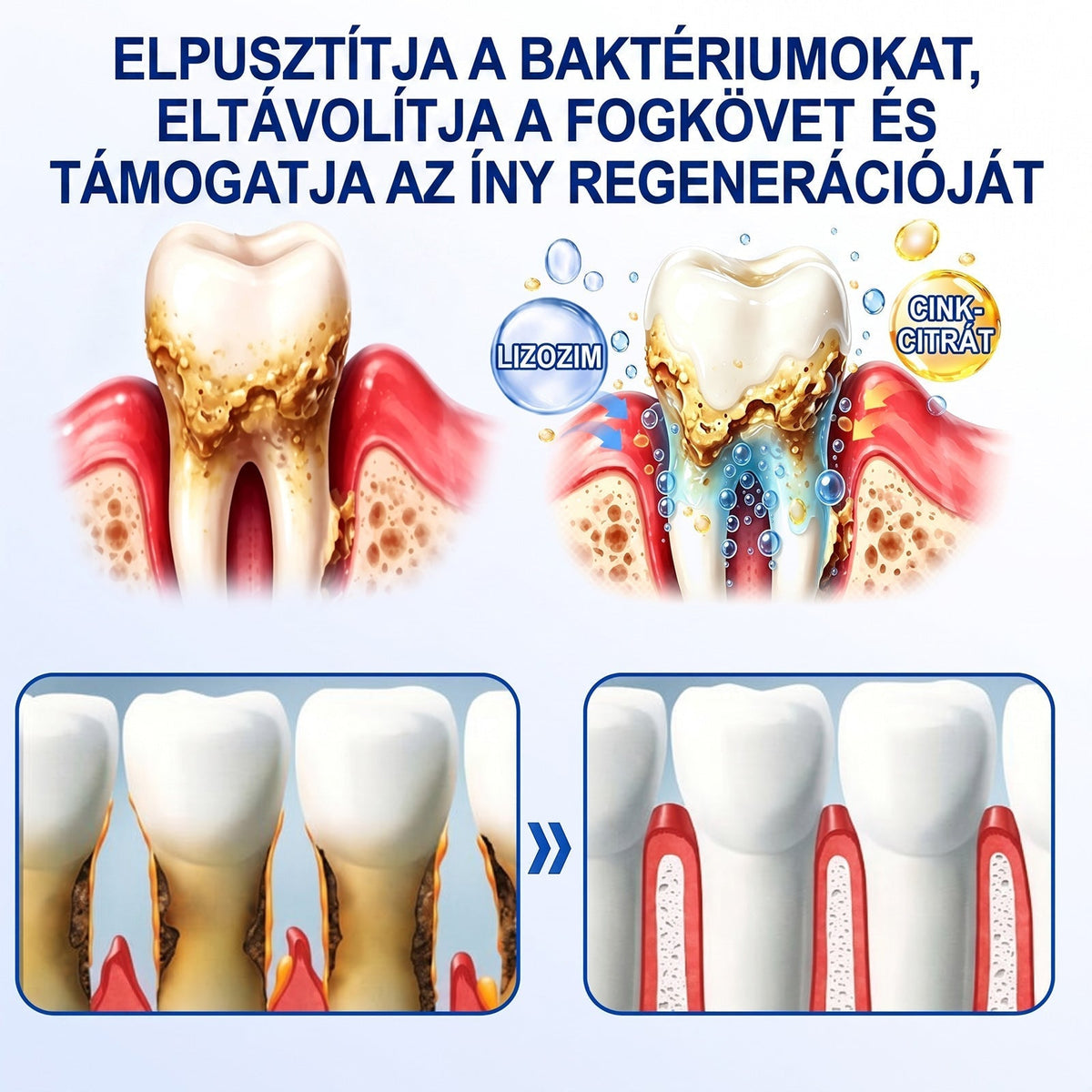 ⚪Dr.Era® GumRevive fogíny- és parodontális regeneráló gél — Célzott ápolás az ínyszélen lepedék, fogszuvasodás, fogágyproblémák, kellemetlen lehelet és meggyengült fogak esetén | Precízen alkalmazható, leöblítést nem igénylő szájápoló formula