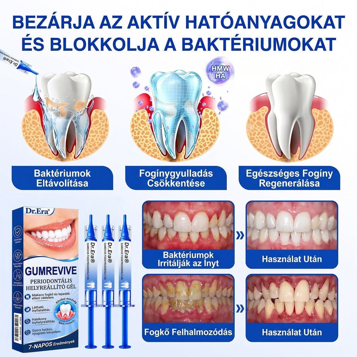 ⚪Dr.Era® GumRevive fogíny- és parodontális regeneráló gél — Célzott ápolás az ínyszélen lepedék, fogszuvasodás, fogágyproblémák, kellemetlen lehelet és meggyengült fogak esetén | Precízen alkalmazható, leöblítést nem igénylő szájápoló formula
