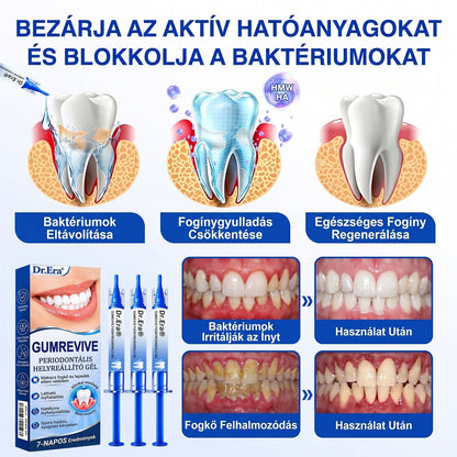 ⚪Dr.Era® GumRevive fogíny- és parodontális regeneráló gél — Célzott ápolás az ínyszélen lepedék, fogszuvasodás, fogágyproblémák, kellemetlen lehelet és meggyengült fogak esetén | Precízen alkalmazható, leöblítést nem igénylő szájápoló formula